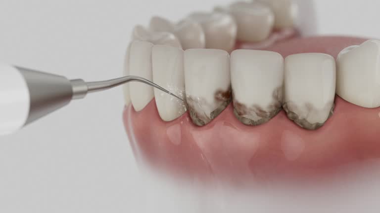 Trusted Teeth Cleaning And Checkup service in Ladson, SC - Dentist Open Now